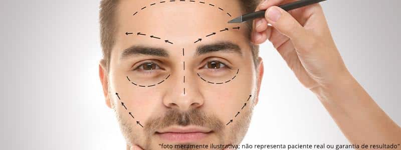 Rinoplastia Masculina: Como diminuir nariz no homem
