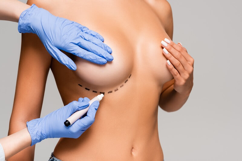 cirurgia de aumento de mama