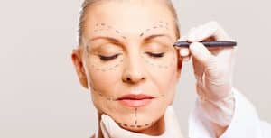 Lifting Facial (rejuvenescimento facial)