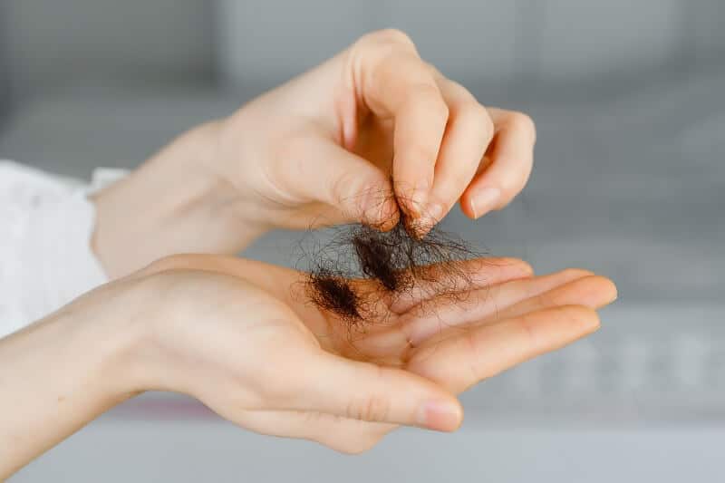 a alopecia areata afeta homens e mulheres