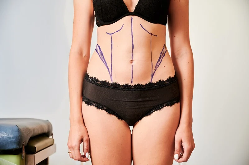 Avaliação do abdome em consulta de cirurgia plástica.