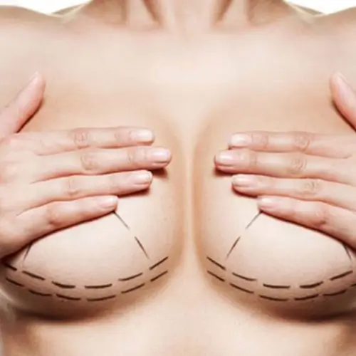 cirurgia plástica das mamas