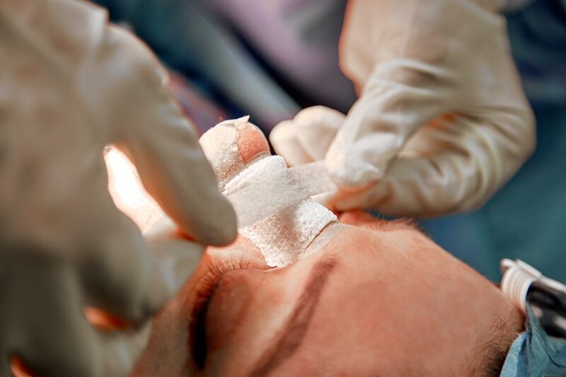 cirurgião qualificado rinoplastia