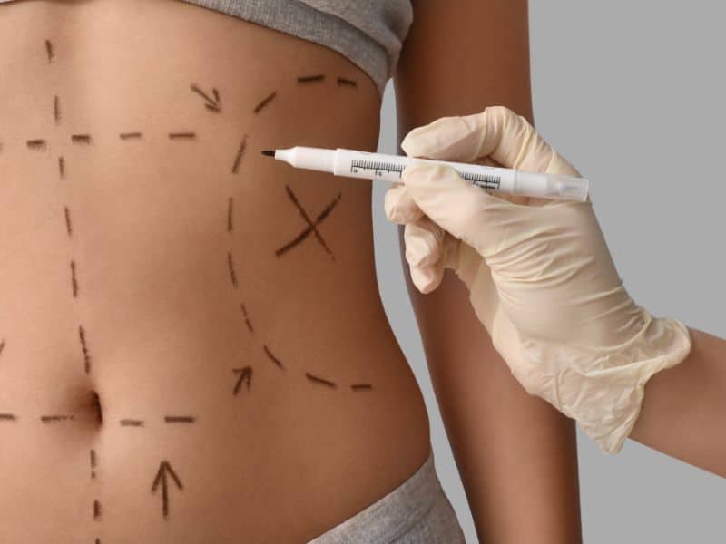 consulta com cirurgião plástico