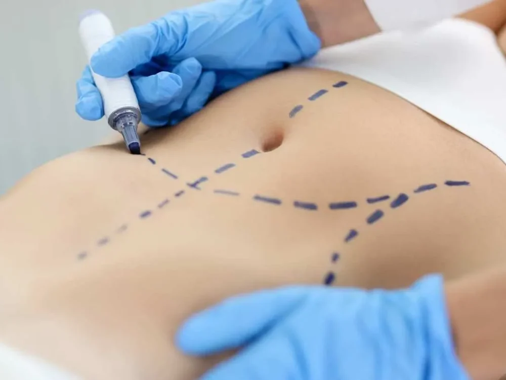 Consulta de avaliação de contorno corporal com cirurgião plástico.