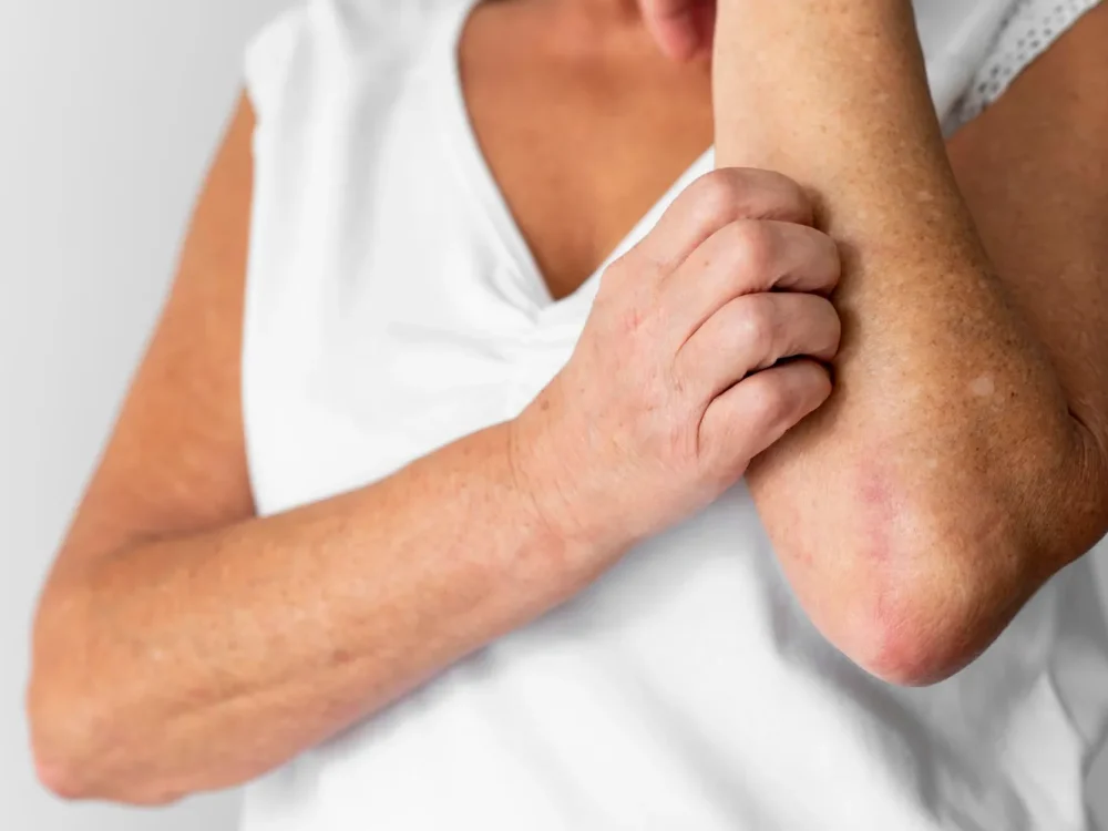 Avaliação dermatológica de lesão inflamatória da pele.