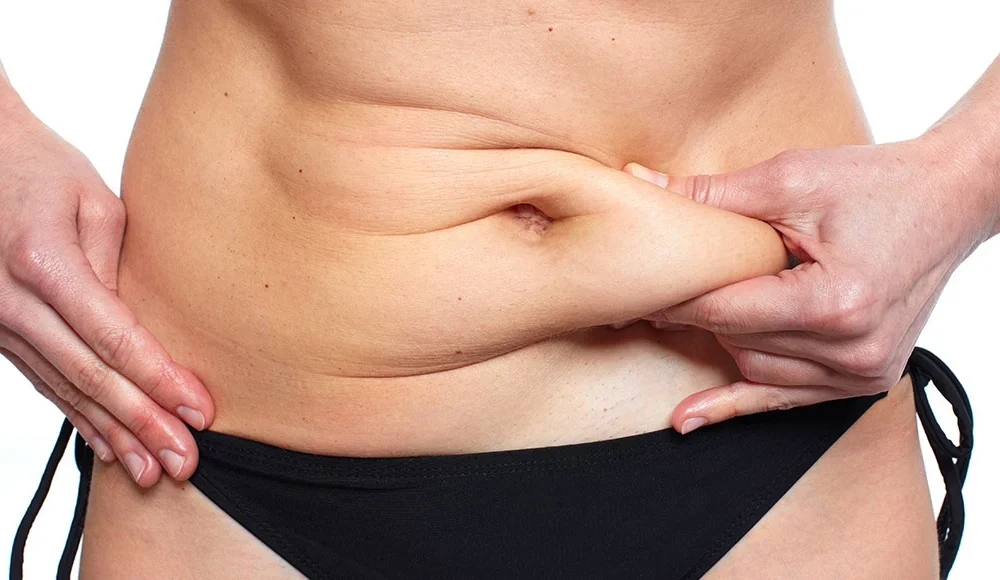Lipoescultura: saiba mais sobre os benefícios dessa técnica para reduzir a gordura localizada!