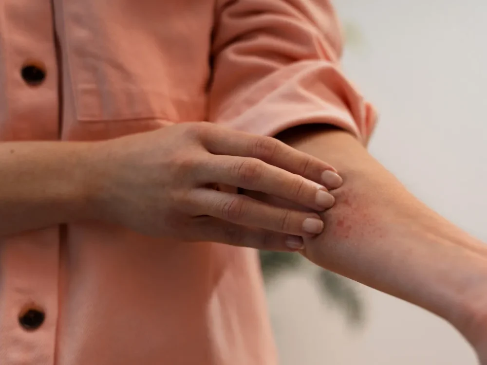 Avaliação dermatológica de lesão de pele.