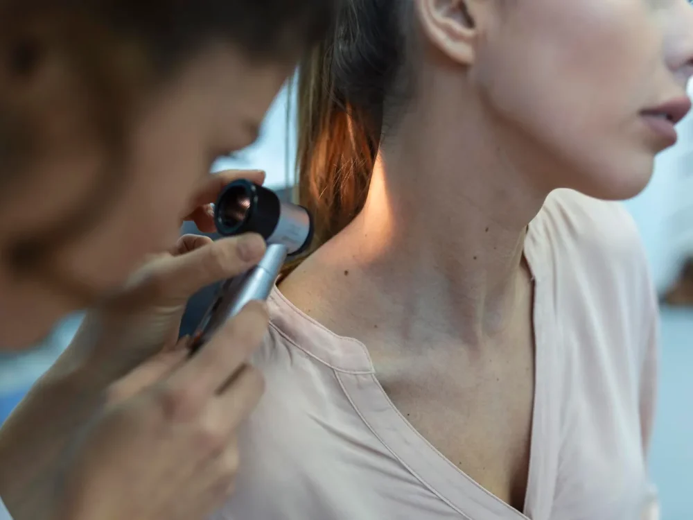 Exame de pinta com dermatoscópio.