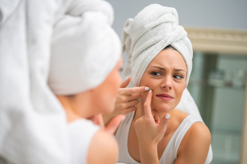remoção de acne
