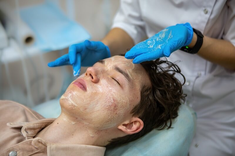 tratamento cicatrizes acne