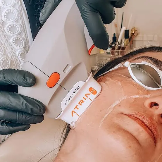 Aplicação de ultrassom facial.